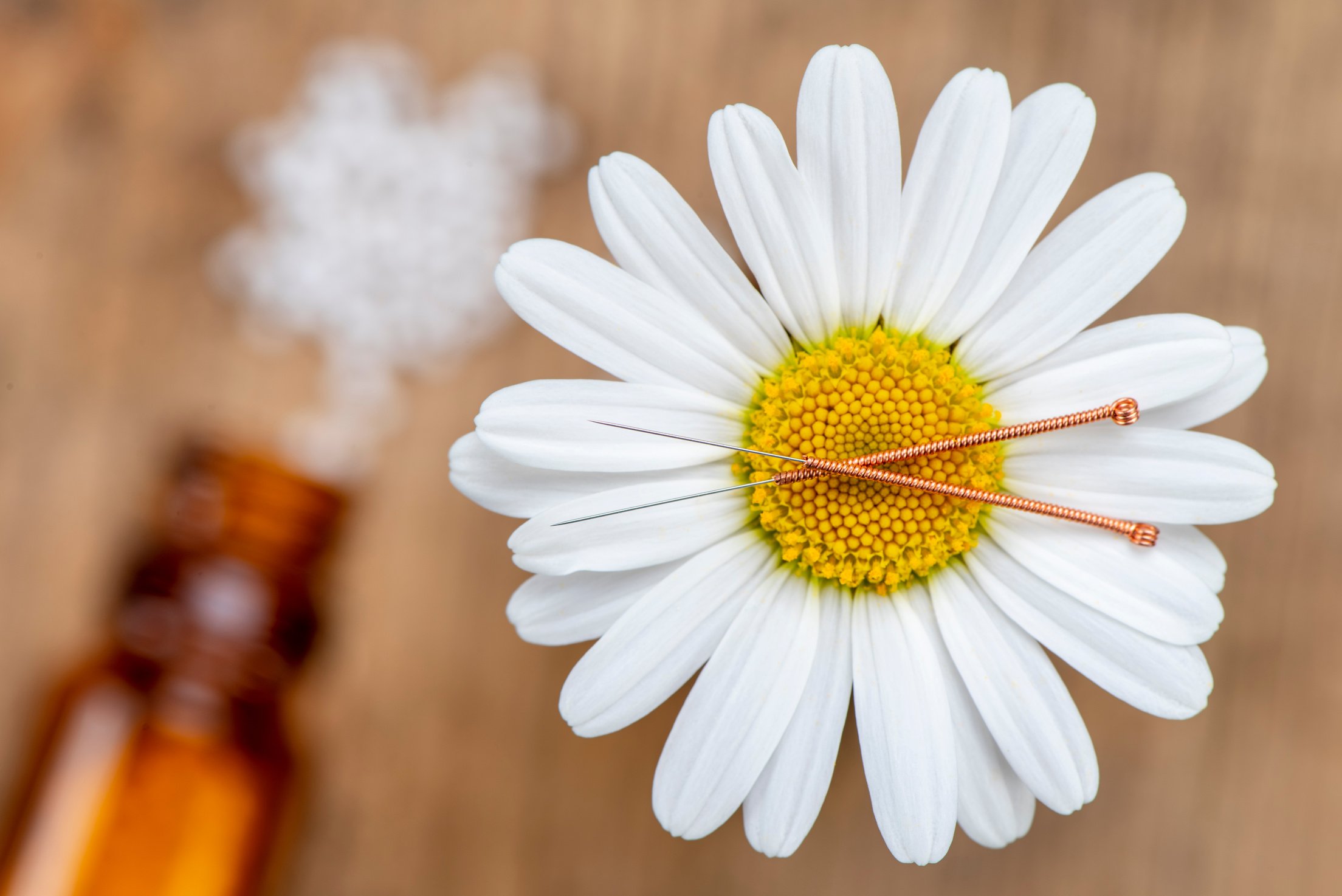 Alternative medicine and acupuncture